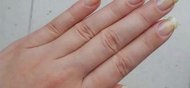 Почему ногти желтеют после снятия лака?